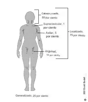 Adenopatía por localización en el cuerpo